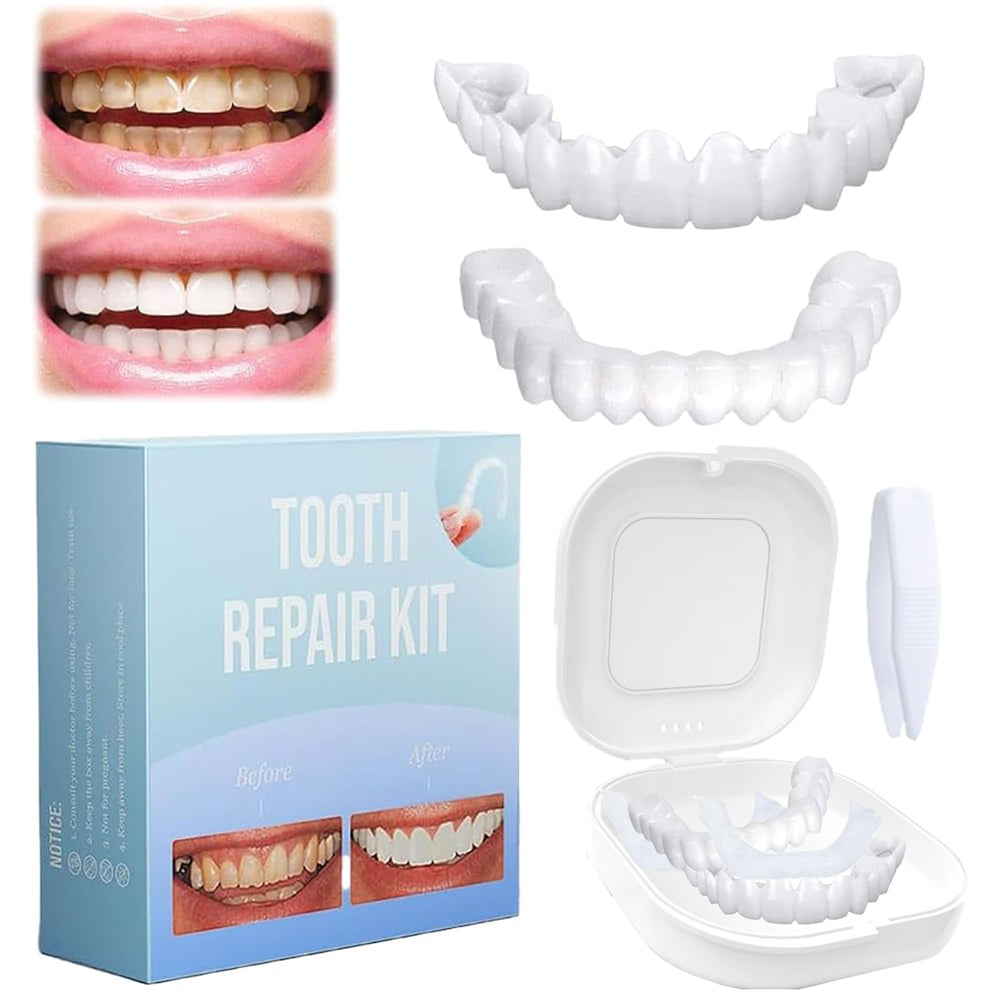 Front view of 1 Set Adjustable Full Dentures and Teeth Veneers for upper and lower jaws