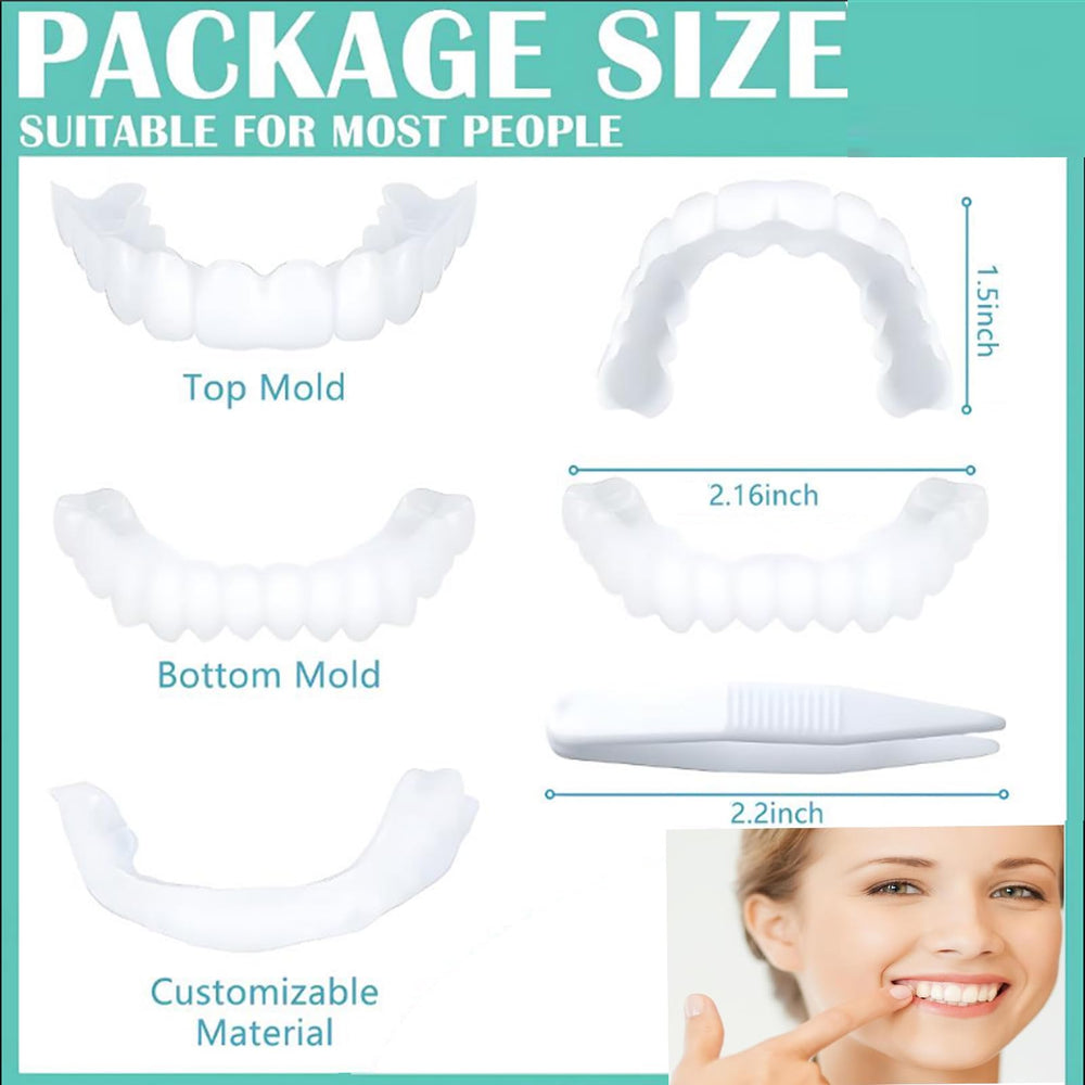 Adjustable dental veneers contouring to upper and lower jaws