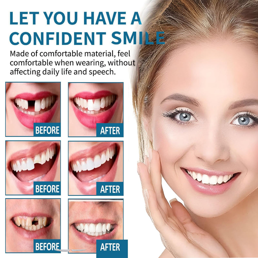 Chew-resistant durable veneers suitable for daily wear