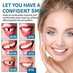 Chew-resistant durable veneers suitable for daily wear