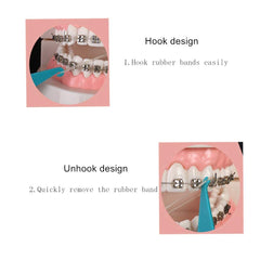 Braces accessories: elastomeric ligature ties pack