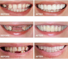 Natural, confident smile effect when worn
