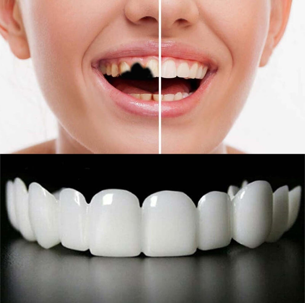 Temporarily adjustable top and bottom dental aligners in white