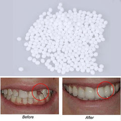 Close-up showing whitening results on teeth
