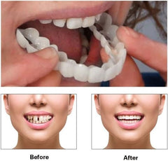 Ultra-portable design of temporary smile kit