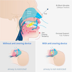 Latex-free replacement straps for Meyson EMA