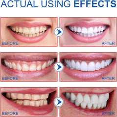 Two SP-6 whitening toothpaste tubes on white background