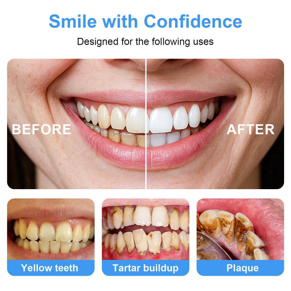 Stainless steel plaque remover and tartar scraper close-up