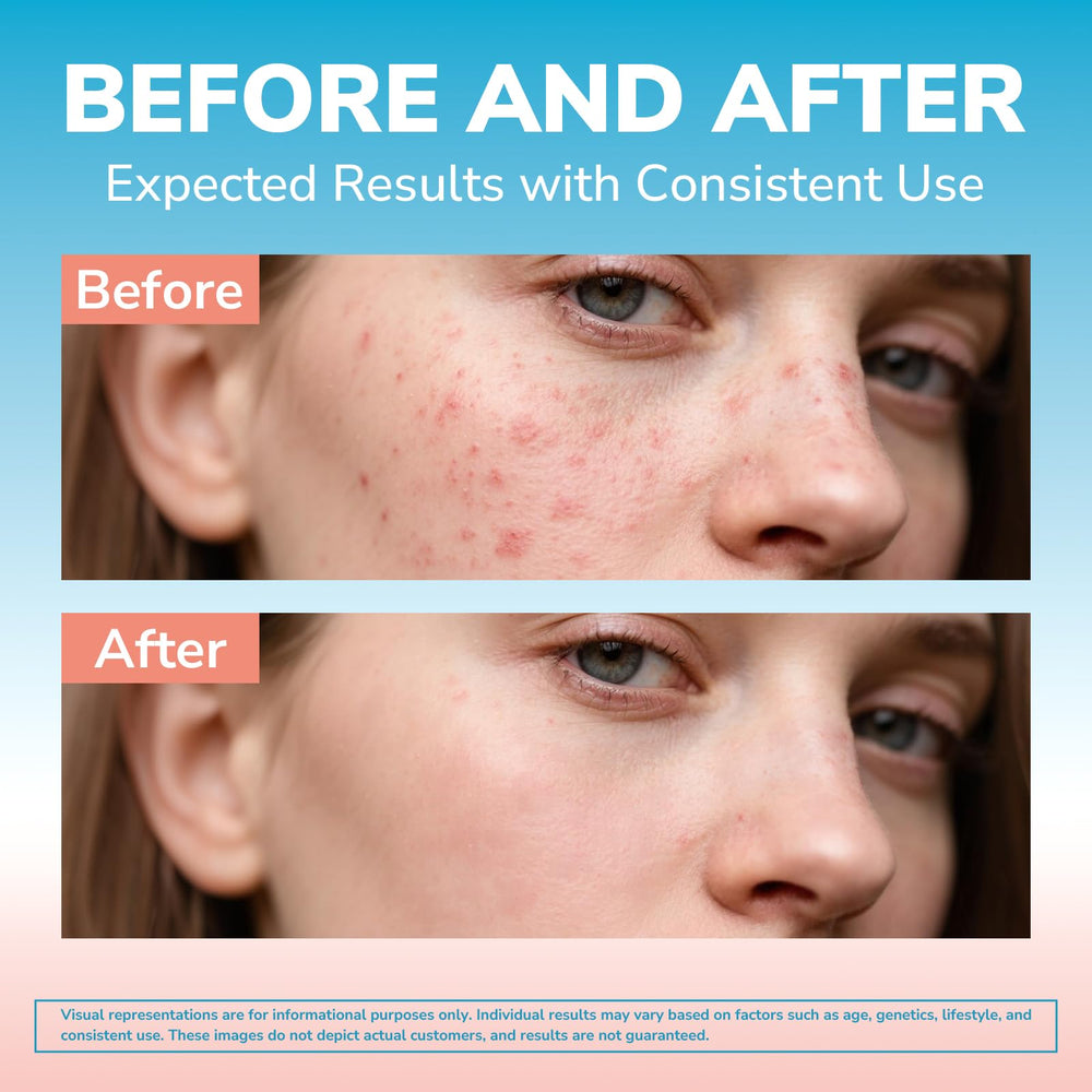 Illustration of the 4-step skin remedy: detox, hydrate, repair, defend