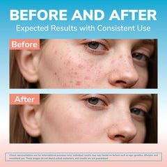 Illustration of the 4-step skin remedy: detox, hydrate, repair, defend