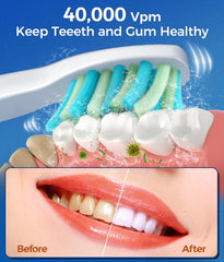 Pack of six replacement toothbrush heads for gum health – White