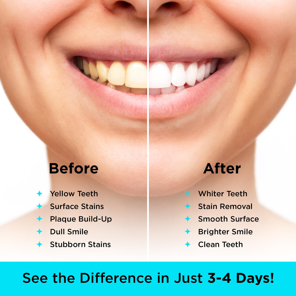 Activated coconut charcoal powder for teeth whitening