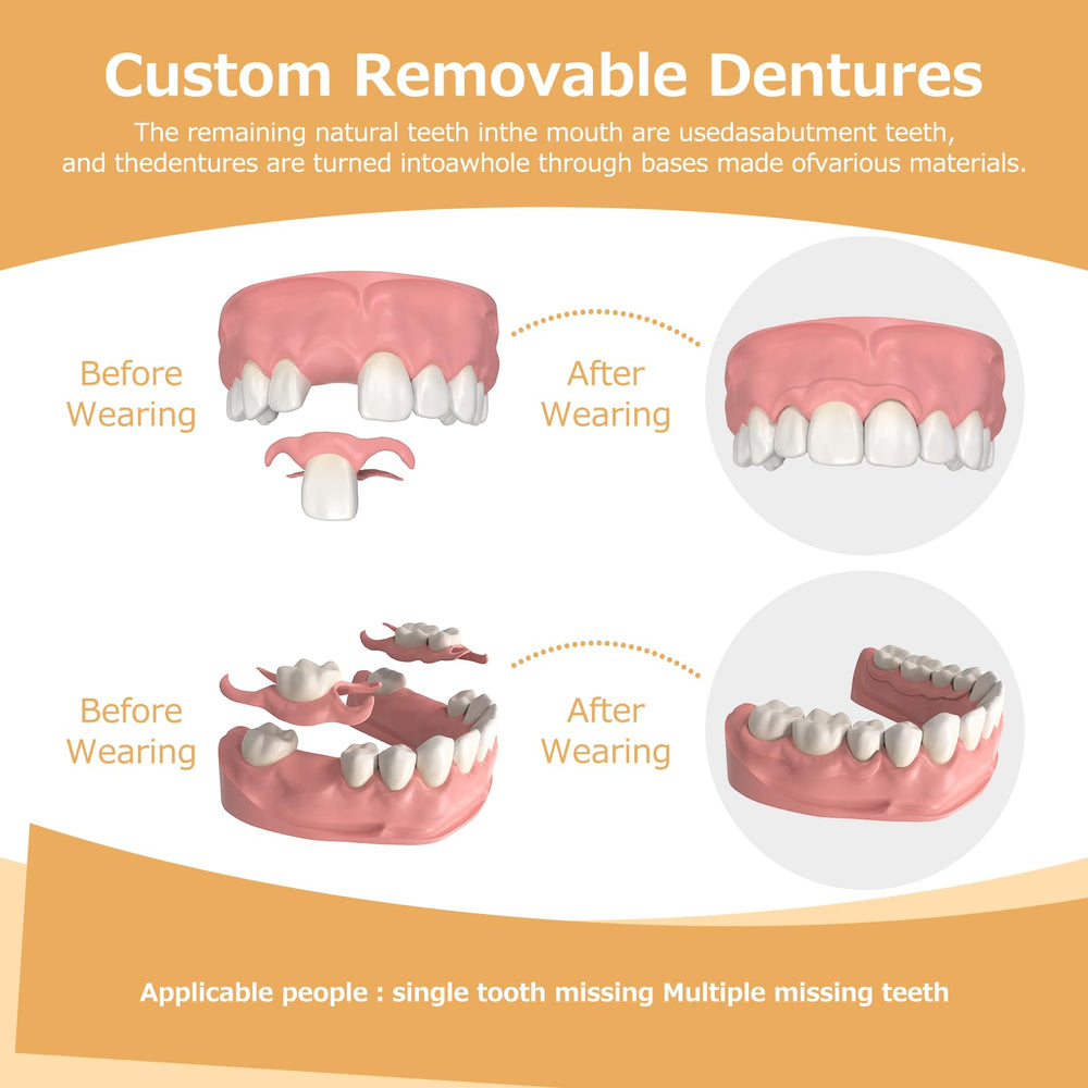 Affordable custom denture crafted by Initsmil Lab