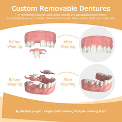 Affordable custom denture crafted by Initsmil Lab