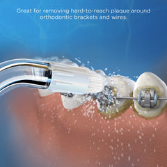 Durable aluminum alloy retainer case