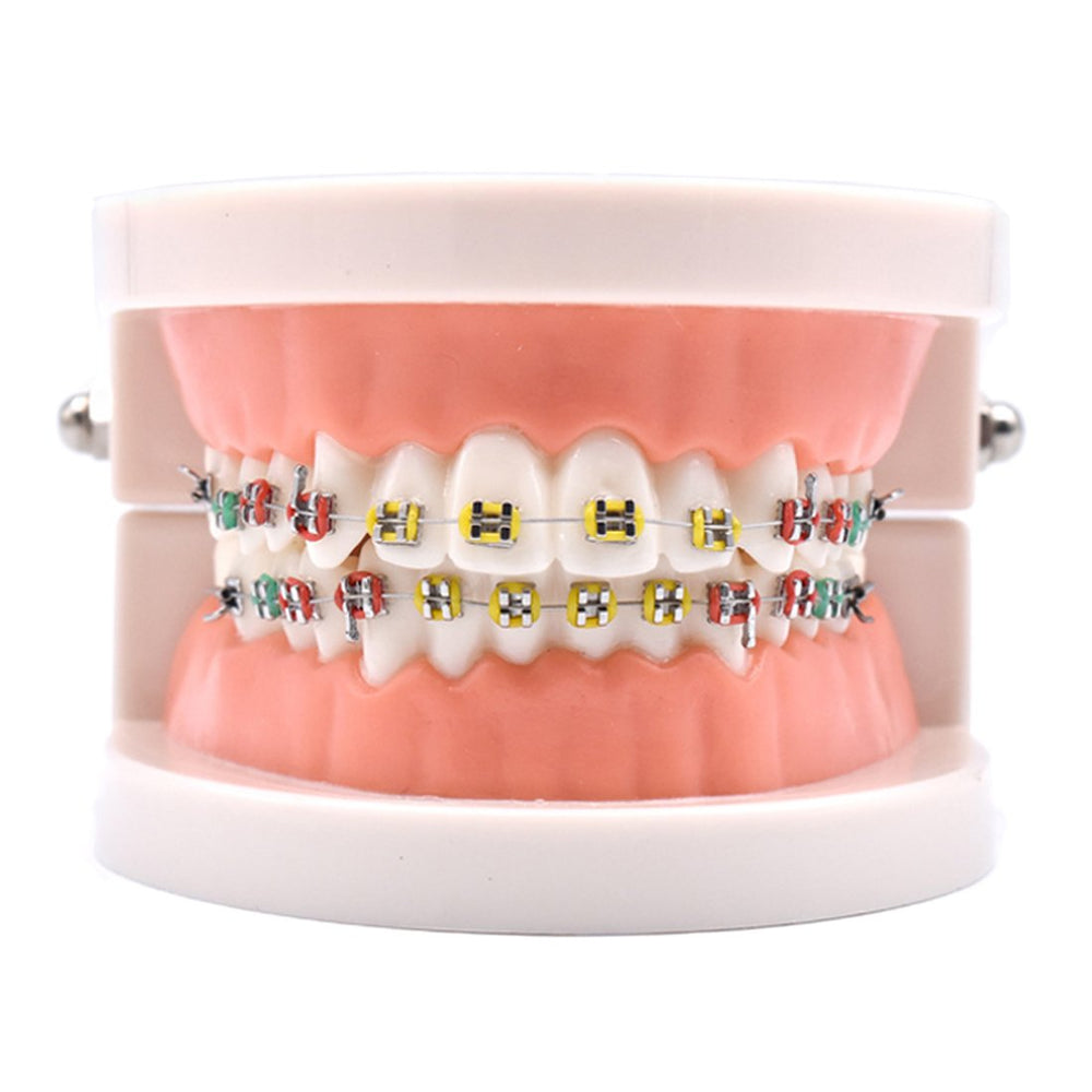 Angzhili orthodontic demonstration model with metal brackets and color ligature ties