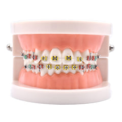 Angzhili orthodontic demonstration model with metal brackets and color ligature ties