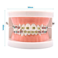Open jaws orthodontic demonstration model showing 180-degree range