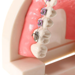 Close-up of metal bracket orthodontic teaching model