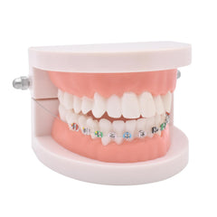 Multi-colored orthodontic wires and brackets demonstration for teaching