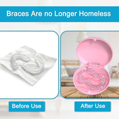 Inclusions: 2 retainer cases, 2 removal tools, 2 chewies in pink packaging