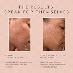 The Honest Youth bottle beside a glass for usage