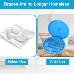 ARGOMAX dishwasher-safe aligner cartridge closeup