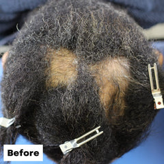 Close-up of Inositol and Ceramide in formula