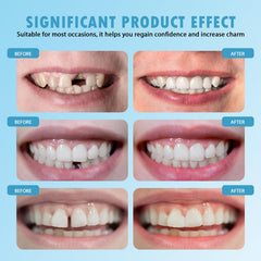 At-home dental restoration scenario with the kit.