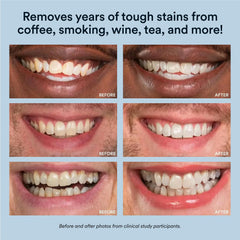 USA-made whitening gel for safety and efficacy