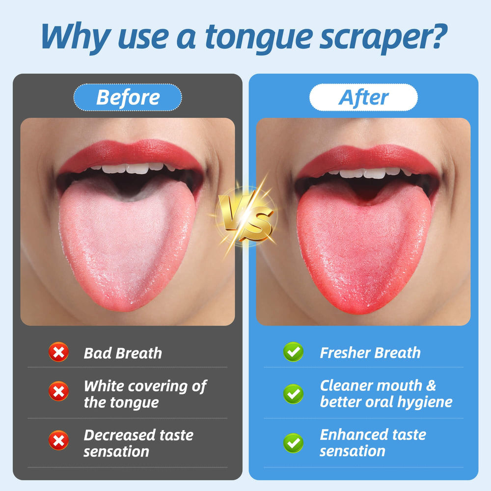 Aussumy tongue scrapers showing four U-shaped and two curved designs