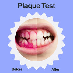 Autobrush Kids toothbrush showing 360-degree mouth coverage