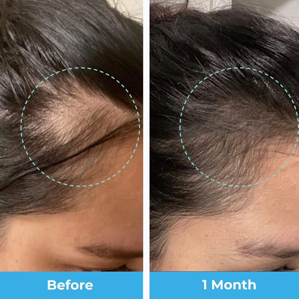 Illustration of hair strands showing regrowth after pregnancy