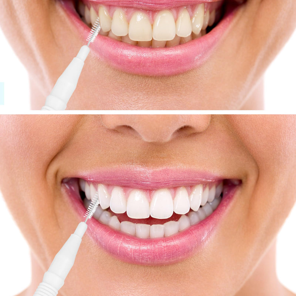 Nylon-coated wire interdental brush protects gums