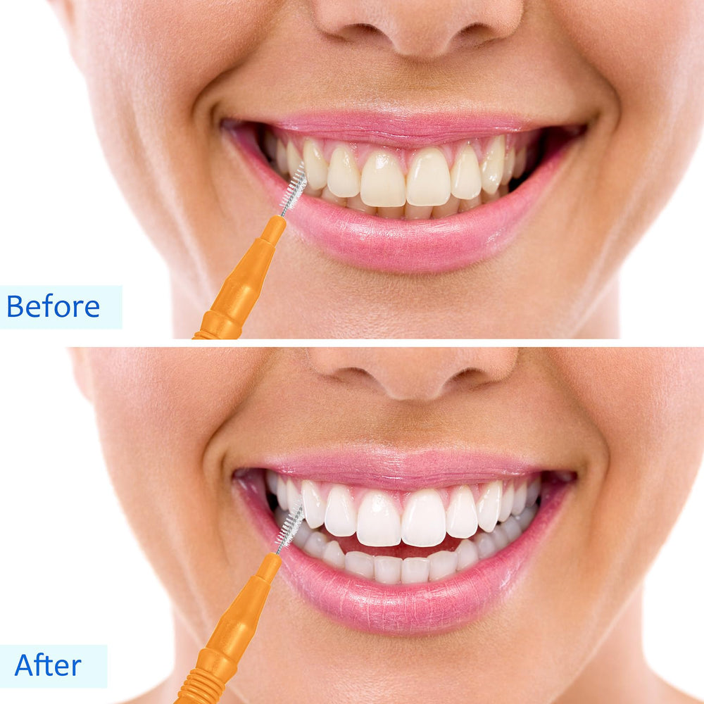 Orange color interdental brushes set of 100 pieces