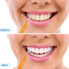 Orange color interdental brushes set of 100 pieces
