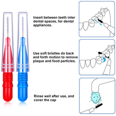 Braces cleaning brush removes plaque between teeth