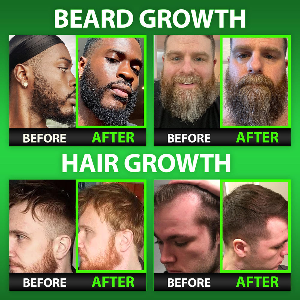 Biotin gummies for beard and hair growth