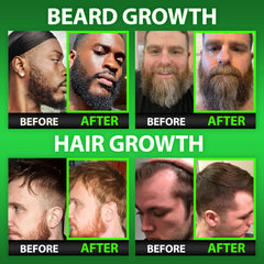 Biotin gummies for beard and hair growth