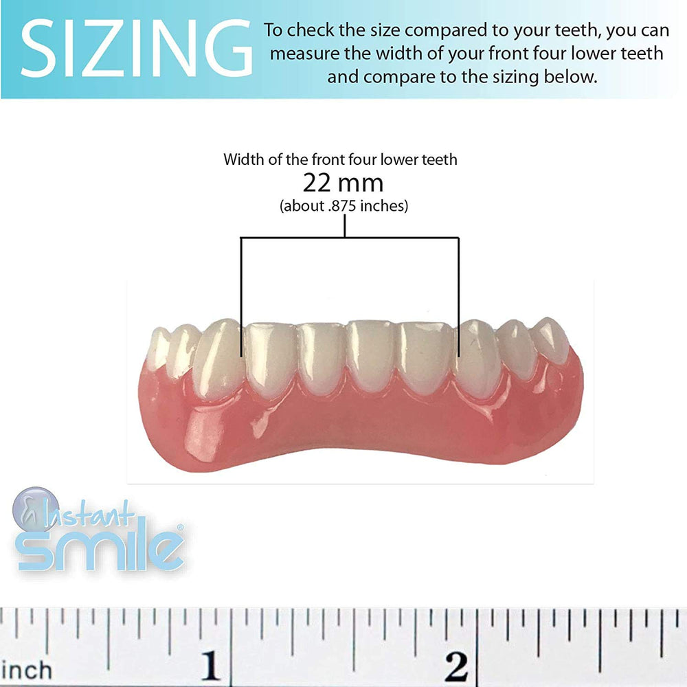 Bottom teeth with veneers fitted for temporary use