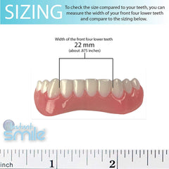 Bottom teeth with veneers fitted for temporary use