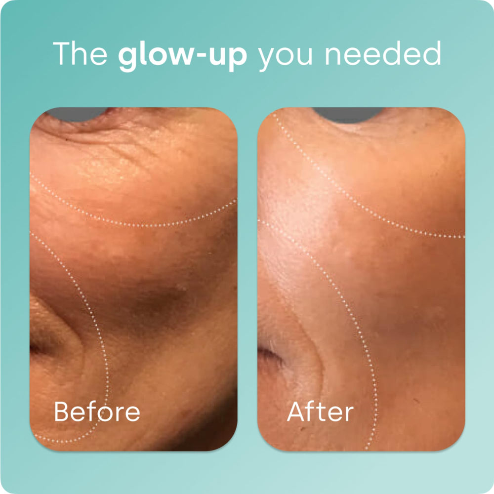 Graphic illustrating collagen production activation