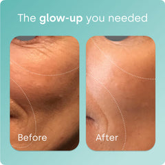 Graphic illustrating collagen production activation by ch-OSA