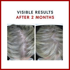 Nutrition facts highlighting 10,000 mcg Biotin per serving