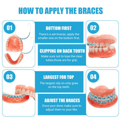 Classroom teaching kit with blue teeth brackets (image 4)