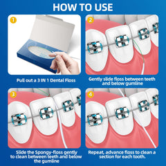 Orthodontic floss threader under braces illustration
