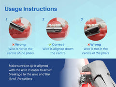 Molar band removal action with pliers