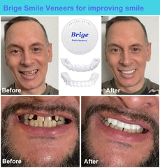 Bottom denture unit for Brige Smile temporary teeth