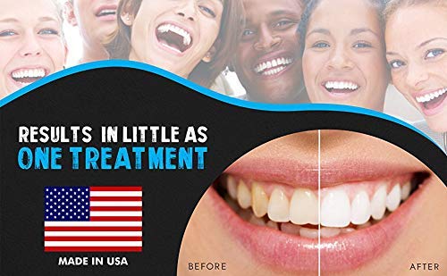 Whitening gel tubes and user instructions