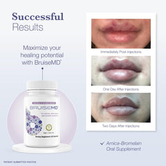 7-day supply packaging and label for BruiseMD